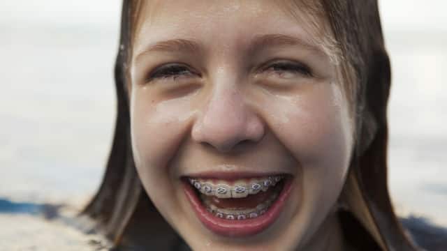 Гигиена полости рта у подростков: правила, которые нужно знать