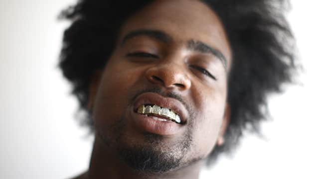 man-with-gold-teeth.jpeg