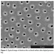 Dentin Tubules